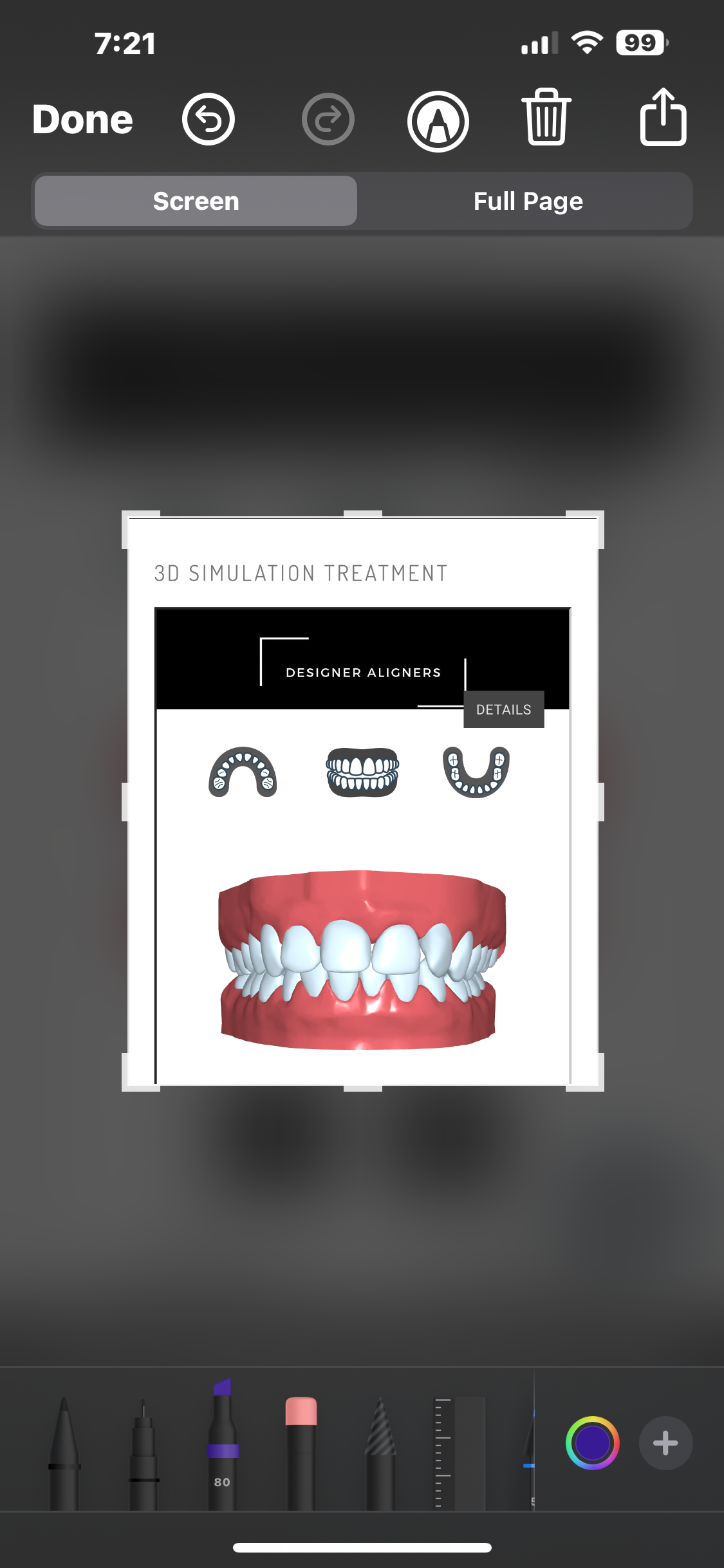 Treatment 3D Simulation