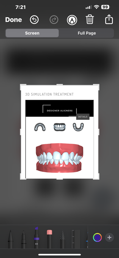 3D Treatment Simulation